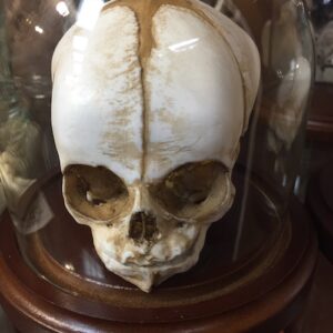 Replica 18 Month Fetal Skull in Glass Dome